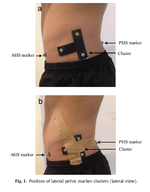 Performance of a lateral pelvic cluster technical system in evaluating running kinematics