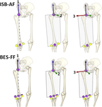 An evaluation of anatomical and functional knee axis definition in the context of side-cutting